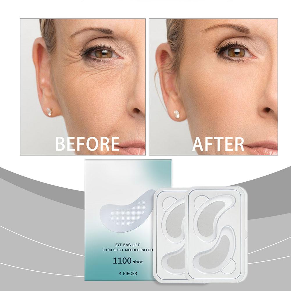 Hyaluronic Acid Microneedle Ey - Microneedle Patch Eye avaliação e preço